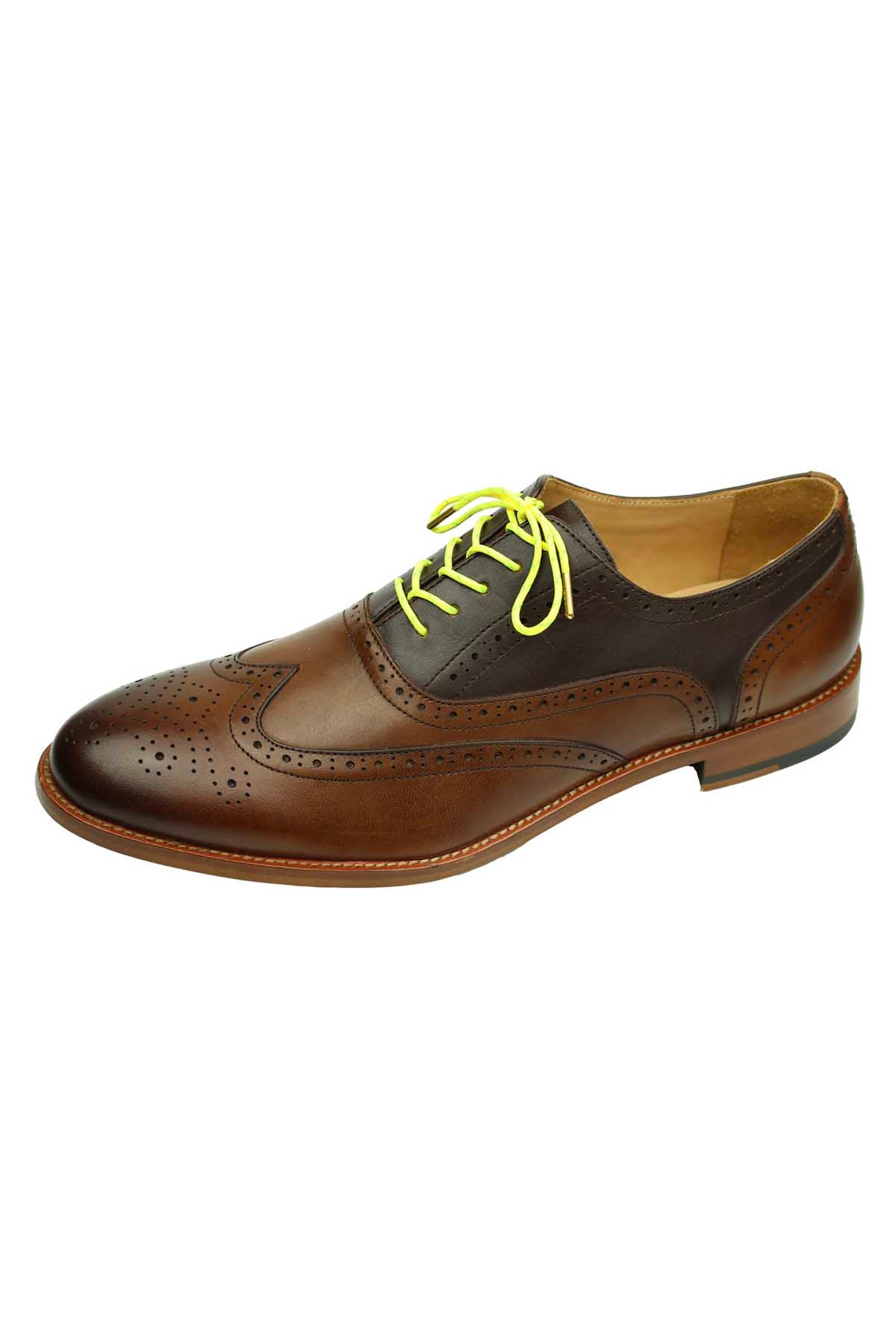 DIBI Bright-Yellow Polkadot Dress Shoelaces w/ Gold Aglets